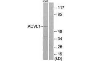 Western blot analysis of extracts from K562 cells, using ACVL1 Antibody. (ACVRL1 Antikörper  (AA 196-245))