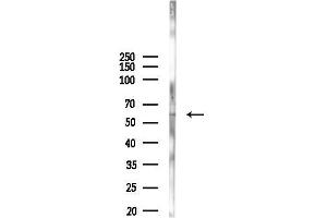 anti-Protein Phosphatase 1, Regulatory Subunit 16A (PPP1R16A) (Internal Region) antibody