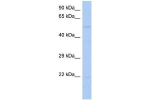WB Suggested Anti-RIPK3 Antibody Titration:  0. (RIPK3 Antikörper  (Middle Region))