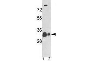 Western blot analysis of VDAC antibody and 1) human A375 cell line and 2) mouse heart tissue lysate. (VDAC1 Antikörper  (AA 1-30))