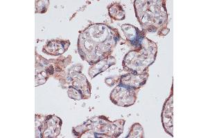 Immunohistochemistry of paraffin-embedded human placenta using RPS13 antibody (ABIN7270012) at dilution of 1:100 (40x lens).