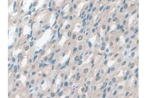 DAB staining on IHC-P; Samples: Rat Stomach Tissue (GSTM4 Antikörper  (AA 21-215))