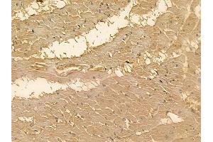 MRS2 Mouse Monoclonal Antibody at 1/100 staining rat heart tissue by IHC-P. (MRS2 Antikörper)