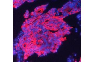 IF analysis of Cytokeratin 19 using anti-Cytokeratin 19 antibody (ABIN5693023). (Cytokeratin 19 Antikörper  (C-Term))