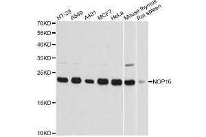 Western blot analysis of extracts of various cell lines, using NOP16 antibody. (NOP16 Antikörper)