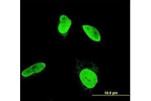 Image no. 3 for anti-Testis-Specific Kinase 2 (TESK2) (AA 405-542) antibody (ABIN599135) (TESK2 Antikörper  (AA 405-542))