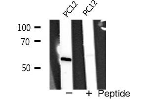 Western blot analysis of TRAF2 expression in PC12 cells (TRAF2 Antikörper  (C-Term))