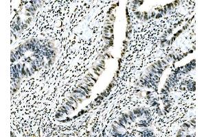IHC analysis of ADAR1/ADAR using anti-ADAR1/ADAR antibody (ABIN7598956).