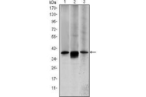 Western blot analysis using MAP2K6 mouse mAb against HepG2 (1), MCF-7 (2) and NIH/3T3 (3) cell lysate. (MAP2K6 Antikörper)