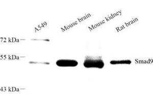 Western blot analysis of SMAD9 (ABIN7075625) at dilution of 1: 1000 (SMAD9 Antikörper)