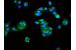 Immunofluorescence staining of PC-3 cells with ABIN7146614 at 1:133, counter-stained with DAPI.