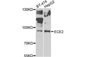 Western blot analysis of extracts of BT474 and HepG2 cells, using ECE2 antibody. (ECE2 Antikörper)