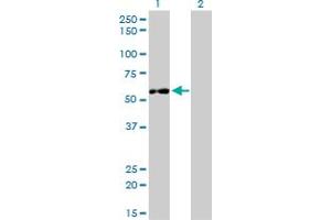 Western Blot analysis of IMPDH2 expression in transfected 293T cell line by IMPDH2 monoclonal antibody (M01), clone 1E12-B6. (IMPDH2 Antikörper  (AA 1-514))