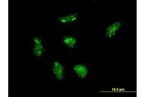 Immunofluorescence of monoclonal antibody to RPL21 on HeLa cell.