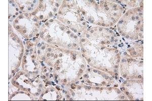 Immunohistochemical staining of paraffin-embedded Human liver tissue using anti-PDE4A mouse monoclonal antibody. (PDE4A Antikörper)