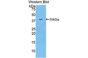 Figure. (MBP Antikörper  (Biotin))