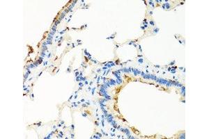 Immunohistochemistry of paraffin-embedded Rat lung using RGS5 Polyclonal Antibody at dilution of 1:100 (40x lens). (RGS5 Antikörper)