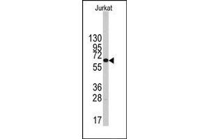 Image no. 1 for anti-6-phosphofructo-2-Kinase/fructose-2,6-Biphosphatase 1 (PFKFB1) (Middle Region) antibody (ABIN360657) (PFKFB1 Antikörper  (Middle Region))