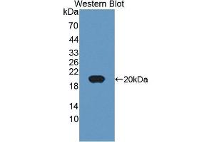Detection of Recombinant MHCDG, Human using Polyclonal Antibody to Cluster Of Differentiation 74 (CD74) (CD74 Antikörper  (AA 78-222))