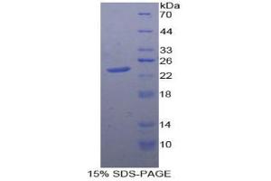 SDS-PAGE analysis of Human PTPRN Protein. (PTPRN Protein)