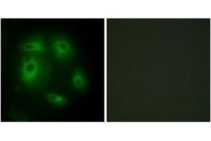 Immunofluorescence (IF) image for anti-Deleted in Lung and Esophageal Cancer 1 (DLEC1) (AA 1-50) antibody (ABIN2889814) (DLEC1 Antikörper  (AA 1-50))