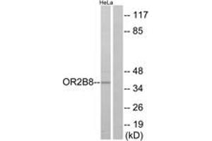 Western blot analysis of extracts from HeLa cells, using OR2B8 Antibody. (OR2B8P Antikörper  (AA 61-110))