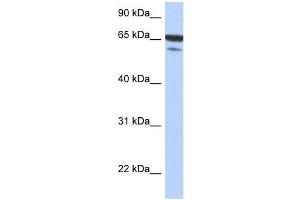 MAP3K7IP1 antibody used at 1 ug/ml to detect target protein. (TAB1 Antikörper  (N-Term))