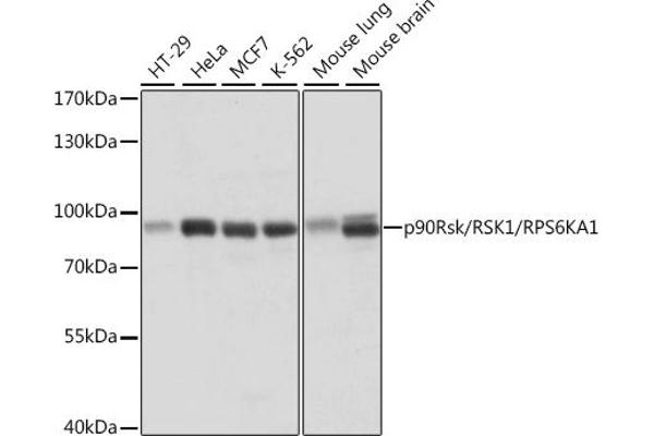 RPS6KA1 抗体  (C-Term)