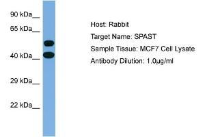 Host: Rabbit Target Name: SPAST Sample Type: MCF7 Whole Cell lysates Antibody Dilution: 1.