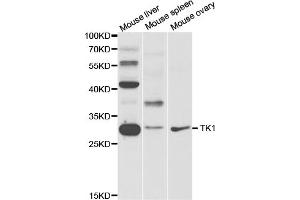 Western blot analysis of extracts of various cell lines, using TK1 antibody (ABIN5973268) at 1/1000 dilution.