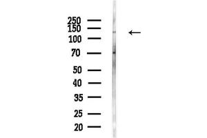 anti-Histone Deacetylase 5 (HDAC5) (pSer498) antibody