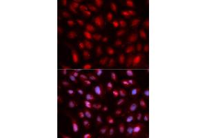 Immunofluorescence analysis of U2OS cell using SUMO2 antibody. (SUMO2 Antikörper  (AA 1-95))