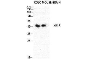 Western Blotting (WB) image for anti-Tachykinin Receptor 1 (TACR1) (Internal Region) antibody (ABIN3185910)