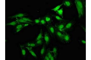 Immunofluorescence staining of Hela cells with ABIN7161386 at 1:133, counter-stained with DAPI.