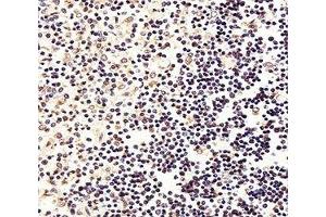 Immunohistochemistry (IHC) image for anti-Forkhead Box P1 (FOXP1) (AA 650-677) antibody (ABIN3030993)
