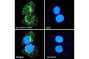 (ABIN184933) Immunofluorescence analysis of paraformaldehyde fixed A431 cells, permeabilized with 0.