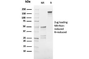 SDS-PAGE Analysis Purified hCG beta Mouse Monoclonal Antibody (HCGb/54). (CGB Antikörper)