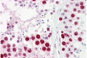 Anti-UBA2 antibody IHC staining of human testis.