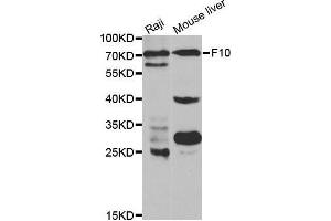 Western blot analysis of extracts of various cell lines, using F10 antibody. (Coagulation Factor X Antikörper  (AA 235-488))
