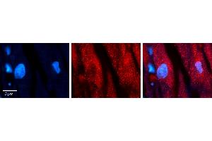 Rabbit Anti-WASL Antibody Catalog Number: ARP63498_P050 Formalin Fixed Paraffin Embedded Tissue: Human heart Tissue Observed Staining: Cytoplasmic Primary Antibody Concentration: 1:100 Other Working Concentrations: N/A Secondary Antibody: Donkey anti-Rabbit-Cy3 Secondary Antibody Concentration: 1:200 Magnification: 20X Exposure Time: 0. (Neural Wiskott-Aldrich syndrome protein (WASL) (Middle Region) Antikörper)