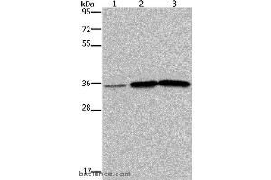 Western blot analysis of Human testis tissue, A549 and PC3 cell, using MAGEA3 Polyclonal Antibody at dilution of 1:400 (MAGEA3 Antikörper)
