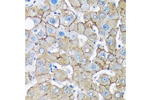 Immunohistochemistry of paraffin-embedded Human liver using UNC13B Rabbit pAb (ABIN7271215) at dilution of 1:100 (40x lens).