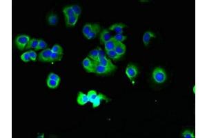 Immunofluorescent analysis of MCF-7 cells using ABIN7172953 at dilution of 1:100 and Alexa Fluor 488-congugated AffiniPure Goat Anti-Rabbit IgG(H+L) (TMCC1 Antikörper  (AA 51-300))