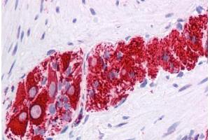 Immunohistochemistry (Formalin-fixed Paraffin-embedded Sections) (IHC (fp)) image for anti-Nuclear Receptor Subfamily 2, Group E, Member 1 (NR2E1) (N-Term) antibody (ABIN574489)