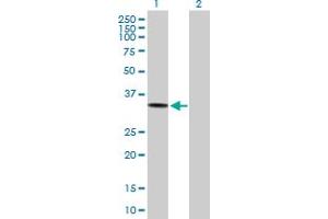 Western Blot analysis of ACP5 expression in transfected 293T cell line by ACP5 MaxPab polyclonal antibody.