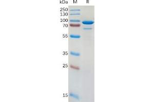 Human CD73 Protein, hFc Tag on SDS-PAGE under reducing condition.