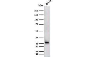 Western Blot Analysis of human Brain tissue lysate using Calretinin Mouse Monoclonal Antibody (CALB2/2602). (Calretinin Antikörper  (AA 23-242))