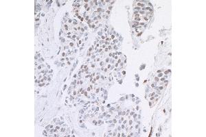 anti-AT Rich Interactive Domain 1B (SWI1-Like) (ARID1B) (AA 1300-1350) antibody