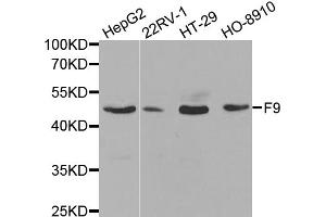 Western blot analysis of extracts of various cell lines, using F9 antibody. (Coagulation Factor IX Antikörper)