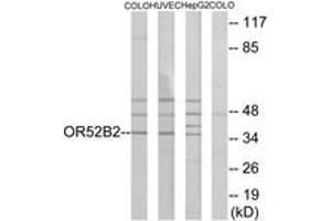 Western blot analysis of extracts from COLO/HuvEc/HepG2 cells, using OR52B2 Antibody. (OR52B2 Antikörper  (AA 201-250))
